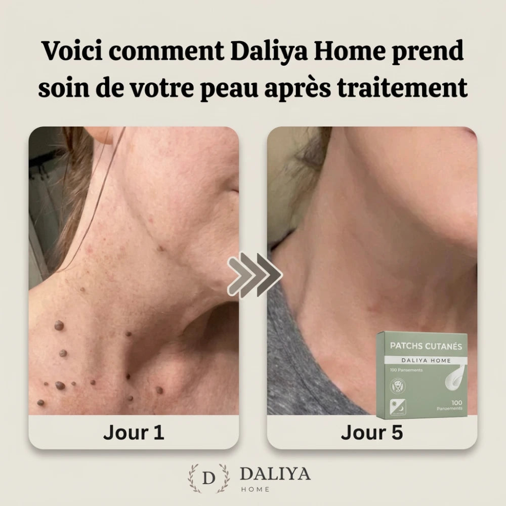 Patchs de soin SkinClear™