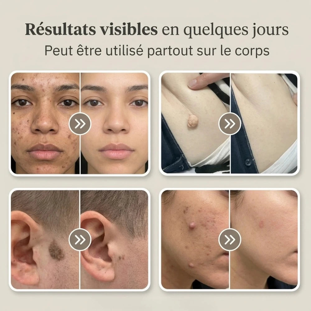 Patchs de soin SkinClear™