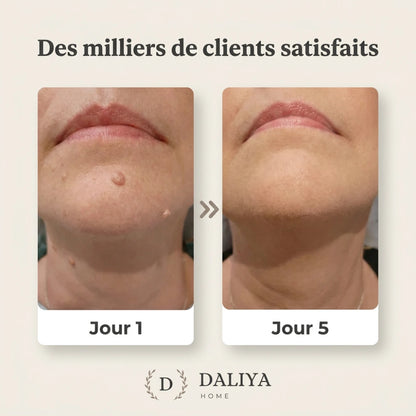 Patchs de soin SkinClear™