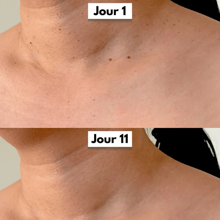 SkinClear™