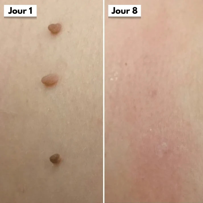 SkinClear™