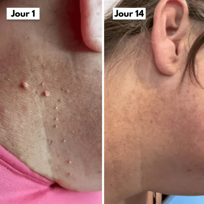 SkinClear™