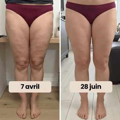 LegPro