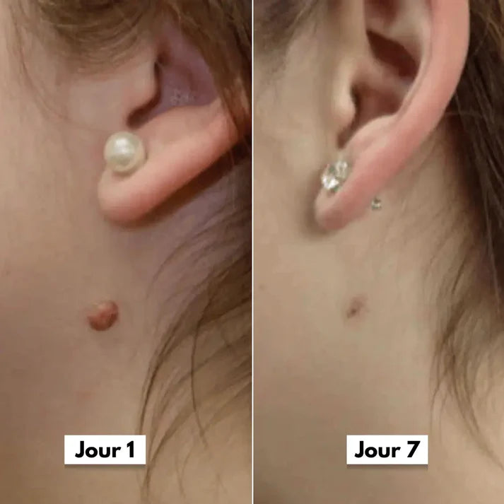 SkinClear™