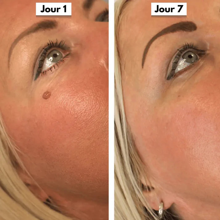 SkinClear™